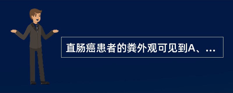 直肠癌患者的粪外观可见到A、白陶土便B、柏油便C、胨状便D、脓血便E、细条便 -