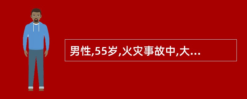 男性,55岁,火灾事故中,大面积烧伤后1d转来,约占全身35%的面积为大小水疱,