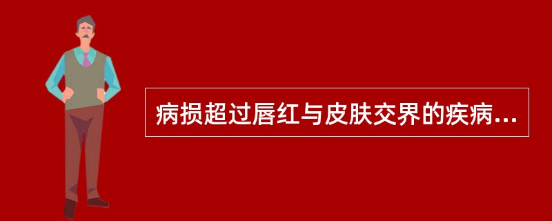 病损超过唇红与皮肤交界的疾病是（）A、唇扁平苔藓B、糜烂型唇炎C、盘状红斑狼疮