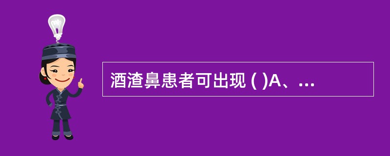 酒渣鼻患者可出现 ( )A、鼻翼发育不良、前鼻孔狭窄B、外鼻皮肤潮红、增厚、粗糙