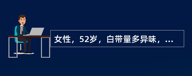 女性，52岁，白带量多异味，检查宫颈粗糙，取宫颈组织活检。显微镜下所见如图。最可