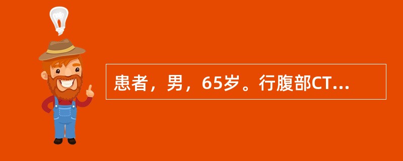 患者，男，65岁。行腹部CT增强扫描，发现腹主动脉异常，如下图：本例应诊断为（）