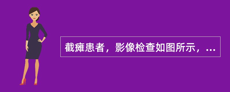 截瘫患者，影像检查如图所示，最可能的诊断是（）