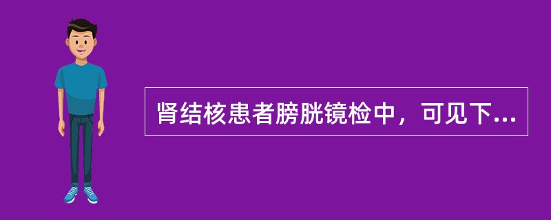 肾结核患者膀胱镜检中，可见下列哪项不正确（）。