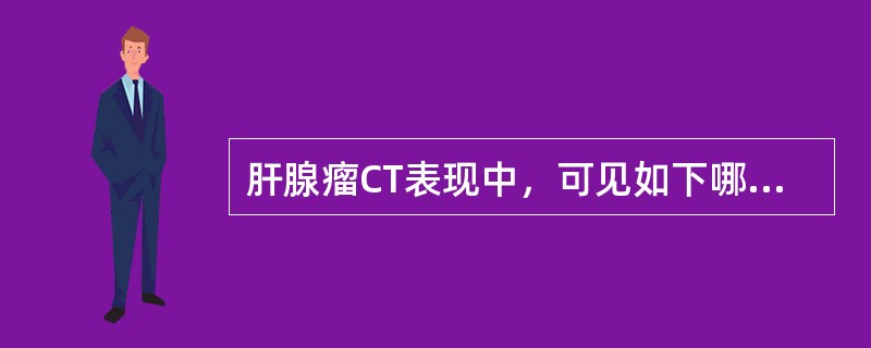 肝腺瘤CT表现中，可见如下哪些征象()