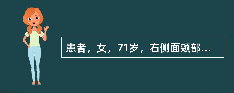 患者，女，71岁，右侧面颊部反复发作性剧烈性疼痛2～3年，每次持续数秒钟，神经系