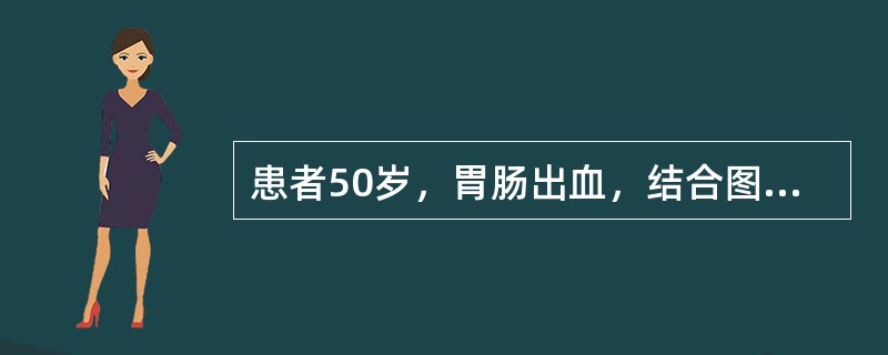 患者50岁，胃肠出血，结合图像，最可能的诊断是()