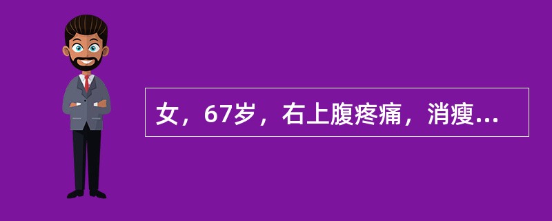 女，67岁，右上腹疼痛，消瘦四月余，CT检查如图，最可能的诊断是()