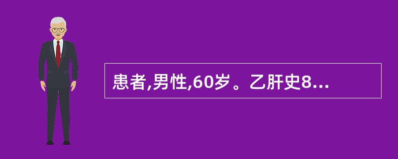 患者,男性,60岁。乙肝史8年。突发右上腹剧痛2小时。查体:血压70£¯50mm