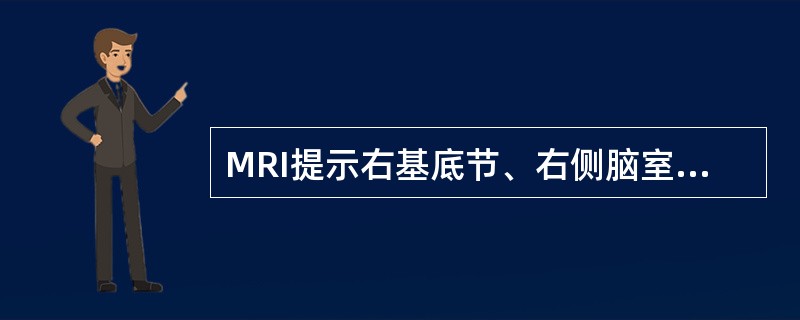 MRI提示右基底节、右侧脑室旁小点片影,血沉、脑脊液检查正常。考虑其病因为