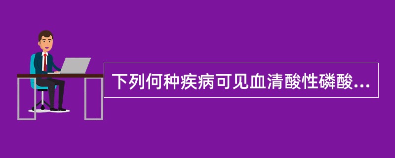 下列何种疾病可见血清酸性磷酸酶大幅升高A、肺癌B、肝癌C、前列腺癌D、卵巢癌E、