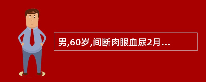 男,60岁,间断肉眼血尿2月余。尿脱落细胞检查发现有肿瘤细胞,膀胱镜检查发现膀胱