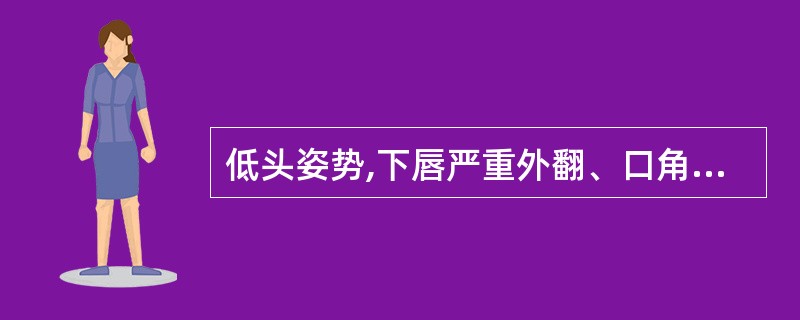 低头姿势,下唇严重外翻、口角、鼻翼均被牵拉向下移位,不能闭口,发音不清、流涎、饮