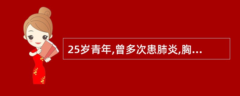 25岁青年,曾多次患肺炎,胸骨左缘3~4肋间Ⅳ级粗糙收缩期杂音,不考虑以下哪一项