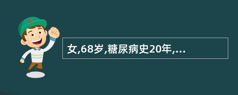 女,68岁,糖尿病史20年,1天前发热、腹泻后突然抽搐、昏迷,人院后查血糖33.