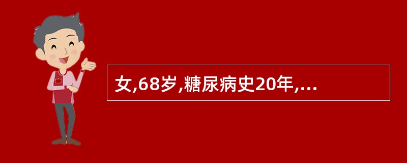 女,68岁,糖尿病史20年,1天前发热、腹泻后突然抽搐、昏迷,入院后查血糖33.