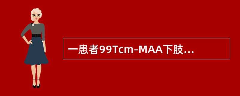 一患者99Tcm-MAA下肢深静脉显像如图，正确的诊断是（）