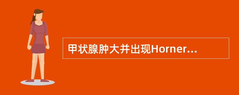 甲状腺肿大并出现Horner综合征时，最可能的诊断是（）。