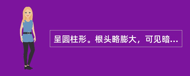 呈圆柱形。根头略膨大，可见暗绿色或暗棕色轮状排列的叶柄残基和密集的疣状突起的药材
