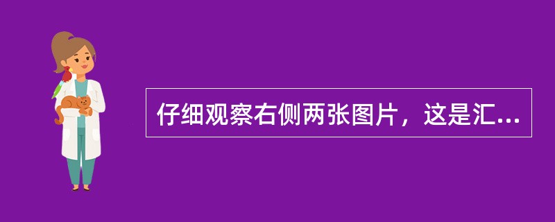 仔细观察右侧两张图片，这是汇丰银行纸币雕刻凹版印刷部分的效果图，从给出的图片信息