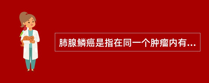 肺腺鳞癌是指在同一个肿瘤内有明确的腺癌和鳞癌的组织结构并存，而且在数量上大致相等