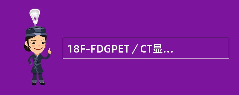 18F-FDGPET／CT显像对于淋巴瘤的应用范围有（）