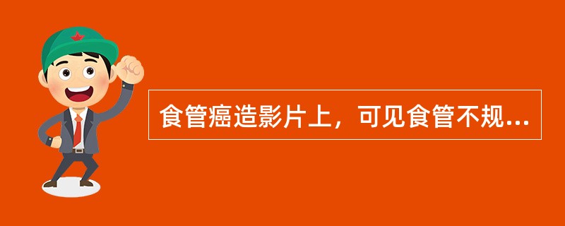 食管癌造影片上，可见食管不规则狭窄，黏膜破坏、中断，管壁僵硬。