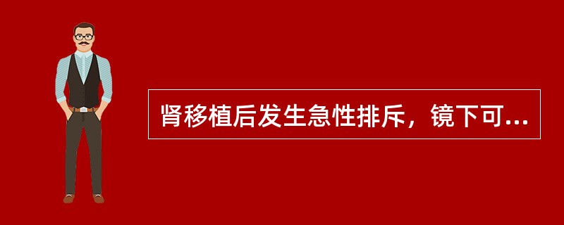 肾移植后发生急性排斥，镜下可见下述细胞浸润，除外