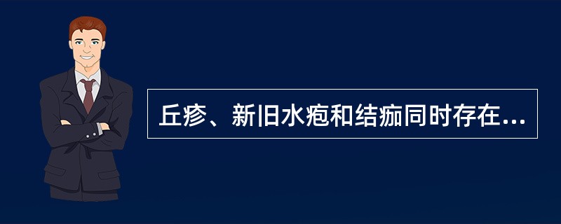 丘疹、新旧水疱和结痂同时存在（）