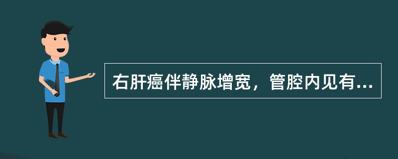 右肝癌伴静脉增宽，管腔内见有中等回声，应考虑为