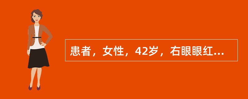 患者，女性，42岁，右眼眼红、眼痛伴视力下降3天。Vod0．3，Vos0；Tod34mmHg，Tos15mmHg；右眼球结膜睫状充血，角膜轻度水肿，尘状KP(++)，前房轴深3C．T．，周边1／4C．