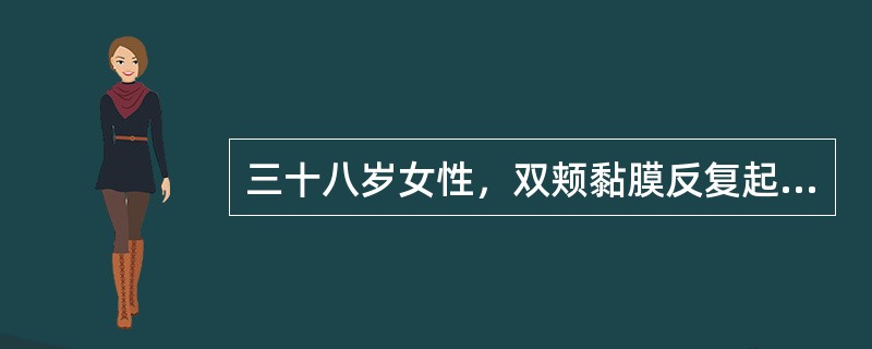 三十八岁女性，双颊黏膜反复起疱1年，与进食无关，查体：右侧颊部可见直径约5mm水疱，疱壁薄而透明，左侧颊部一直径约7mm鲜红糜烂面，可见残留疱壁，探针可无痛性探入糜烂面边缘的黏膜下方下列说法错误的是