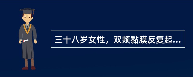 三十八岁女性，双颊黏膜反复起疱1年，与进食无关，查体：右侧颊部可见直径约5mm水疱，疱壁薄而透明，左侧颊部一直径约7mm鲜红糜烂面，可见残留疱壁，探针可无痛性探入糜烂面边缘的黏膜下方最可能的诊断为