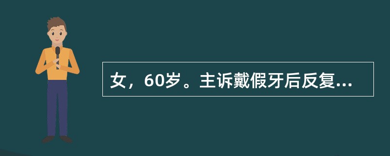 女，60岁。主诉戴假牙后反复出现口底部疼痛2个月。检查：舌系带附着处有一线状溃疡，约2.0cm×0.2cm大小，周边有组织增生，戴义齿后，义齿舌侧基托边缘正好压迫于溃疡处最有效的处理方法是