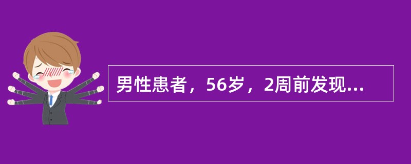 男性患者，56岁，2周前发现右下后牙龈有小包，平时无明显不适，右下第一前磨牙咬合面龋深及髓腔，牙髓无活力，叩痛(-)，X线片见：右下第一前磨牙根尖透射区不规则，边界模糊。主诉牙应诊断为