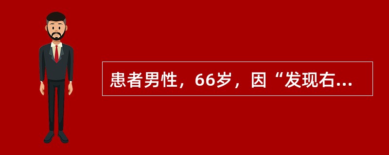 患者男性，66岁，因“发现右下后牙龈有红色小包3周”来诊。患者平时无明显不适，右下第2前磨牙面龋深及髓，牙髓无活力，叩痛（-）。X线片：右下5根尖X线透射区不规则，边界模糊。主诉牙应是