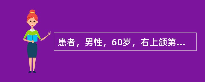 患者，男性，60岁，右上颌第一、二磨牙残根，不松，左上颌中切牙和侧切牙松动Ⅲ度，根露1／2，测血压160／90mmHg，心电图检查正常拔除<img border="0" st