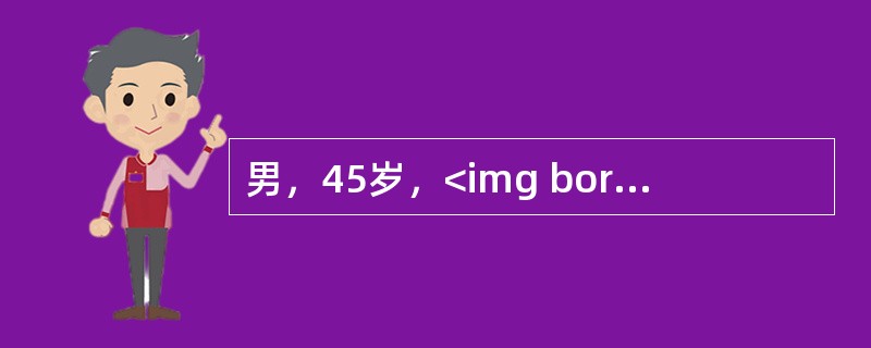 男，45岁，<img border="0" style="width: 24px; height: 16px;" src="https://im