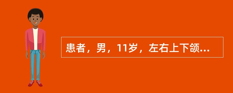 患者，男，11岁，左右上下颌第一磨牙反袷，左右上尖牙缺失，上颌后缩，下颌前突，前牙反，面中1／3凹陷，下颌可后退至对刃。X线见左右上尖牙龈下3mm阻生，侧切牙与第一前磨牙之间各3mm间隙。为治疗上颌后