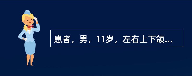 患者，男，11岁，左右上下颌第一磨牙反袷，左右上尖牙缺失，上颌后缩，下颌前突，前牙反，面中1／3凹陷，下颌可后退至对刃。X线见左右上尖牙龈下3mm阻生，侧切牙与第一前磨牙之间各3mm间隙。病例应诊断为