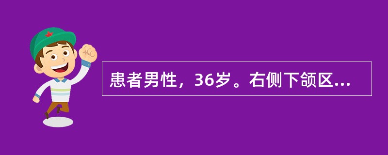 患者男性，36岁。右侧下颌区无痛性肿胀逐渐加重八月，无疼痛及麻木感。检查见面部不对称，右侧下颌区膨隆。表面皮肤色、温正常。口内相应区域移行沟丰满，触诊有乒乓球感，穿刺可抽出褐色液体，显微镜下未见胆固醇
