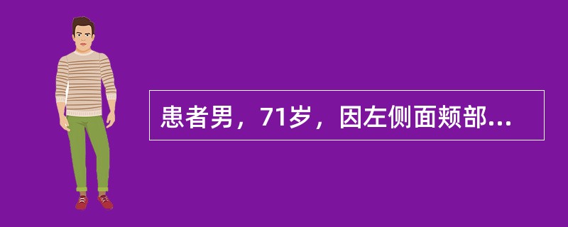 患者男，71岁，因左侧面颊部疼痛三年入院，疼痛为针刺样，分布在左唇部及鼻翼旁，每次发作持续5～20秒钟，吃饭，说话等可诱发疼痛。口服卡马西平0.1tid，效果欠佳，加量后伴有头晕症状。三叉神经痛治疗方