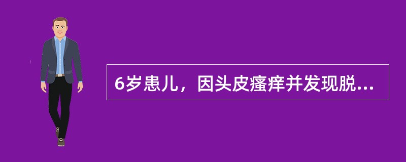 6岁患儿，因头皮瘙痒并发现脱发斑2周就诊，家中养猫。查体头皮散在5～6处1～2cm直径大小脱发斑，表面少许鳞屑，其上可见断发2～4mm长。最可能的诊断