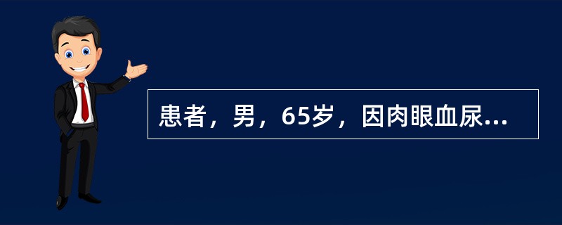 患者，男，65岁，因肉眼血尿2周就诊。无明确原因肉眼全程血尿，无腰痛、下肢水肿，实验室检查：血常规正常，尿常规镜检满视野红细胞，X线平片无异常征象。患者行IVP及CT检查，图像如下，应考虑患何种疾病&