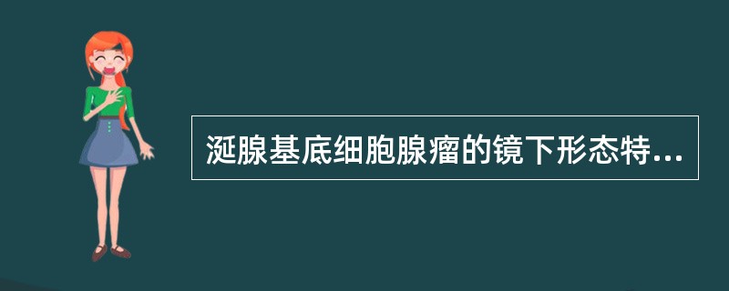 涎腺基底细胞腺瘤的镜下形态特点包括