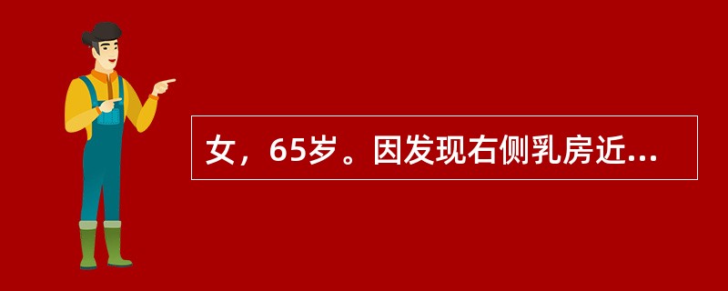 女，65岁。因发现右侧乳房近乳头处包块半年来院就诊，既往体健。查体：右侧乳腺外上象限近乳头处可触及约3cm×5cm质硬肿物，肿物局部皮肤稍凹陷，无压痛，边界尚清，腋窝未触及明显肿大淋巴结。提示：患者切