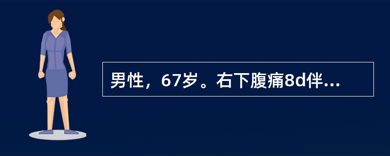 男性，67岁。右下腹痛8d伴呕吐，体温35℃，脉搏120次/分，血压10.7/6.67kPa(80/50mmHg)，神志不清，烦躁不安，全腹压痛、反跳痛.四肢冰冷、青紫呈花斑发绀，尿量＜25ml/h。