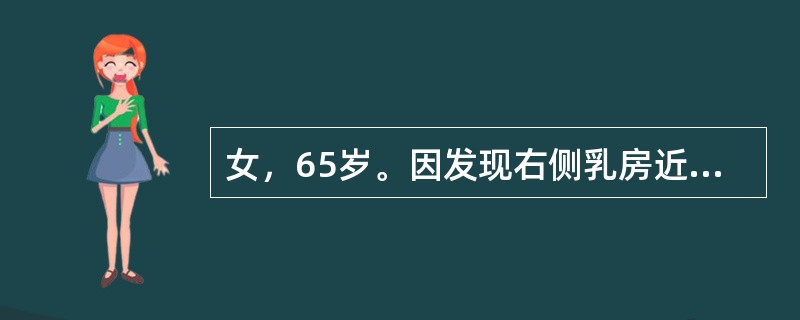 女，65岁。因发现右侧乳房近乳头处包块半年来院就诊，既往体健。查体：右侧乳腺外上象限近乳头处可触及约3cm×5cm质硬肿物，肿物局部皮肤稍凹陷，无压痛，边界尚清，腋窝未触及明显肿大淋巴结。提示：行右侧