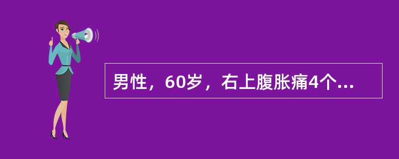 男性，60岁，右上腹胀痛4个月伴黄疸1个月余。体格检查：肝肋下4cm，剑突下5cm，质硬，移动性浊音(+)与该病最无关的因素是()