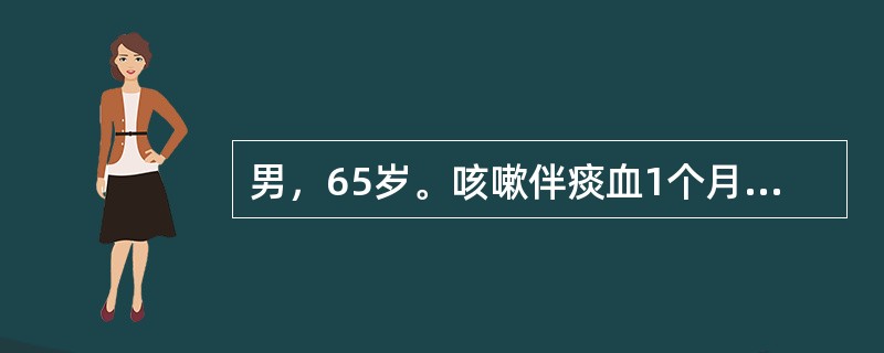 男，65岁。咳嗽伴痰血1个月，X线胸片及CT示左下叶背段2cm×2cm肿块，分叶状，肺门淋巴结无肿大，右上纵隔淋巴结5cm×5cm，痰找到低分化腺癌细胞临床分期为